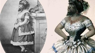 القصة المأساوية لـ”المرأة القرد”.. أقاموا عروض السيرك بجثتها لأكثر من قرن