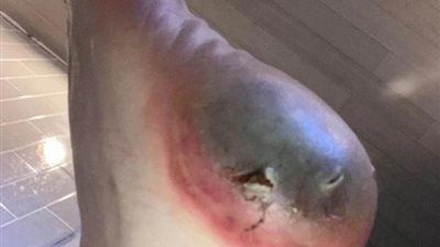 لمصلحة من.. مجهولين يحاربون لقاحات كورونا بنشر صور مزيفة عن أعراضه الجانبية