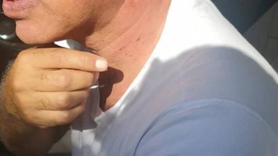 عاجل بالصور.. إصابة ايمن يونس بجروح وتحطيم سيارته عقب الهجوم عليه من مجهولين