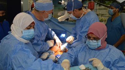 بالصور .. تفاصيل جراحة دقيقة ونادرة لفصل توأم ملتصق بمستشفي الدمرداش الجامعي