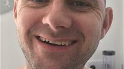 بعد إزالة جزء من دماغه وفقدانه للذاكرة.. بريطاني يصحو من الغيبوبة ليحتفل مع أسرته بعيد الميلاد