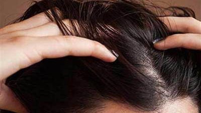 10 طرق فعالة توفر العناية بالشعر الدهني في الصيف