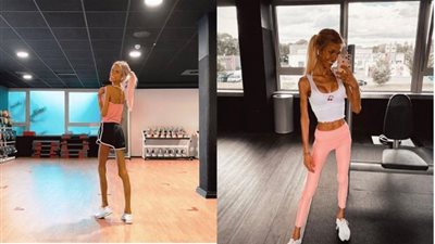 «مش هتصدق».. حكاية المدونة التى فقدت حياتها بعمر 24 عاما بسبب فقدان الشهية