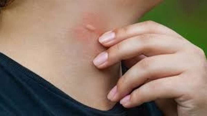 نصائح تحمي نفسك من