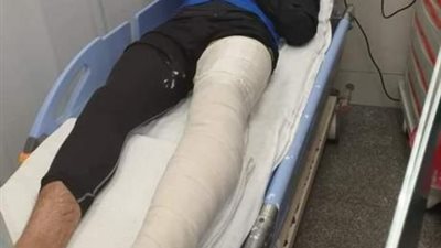 شاهد.. مدافع الاتحاد السكندري في المستشفي لإجراء جراحة في الساق