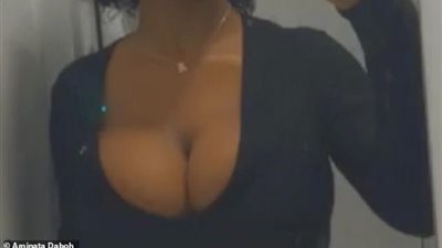 طالبة جامعية تجمع التبرعات لدفع تكاليف عملية لتصغير حجم الثدي