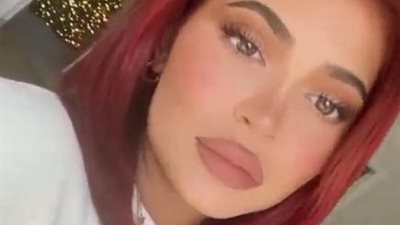 تحذير.. نجمات السينما والمشاهير في خطر.. أحد لقاحات كورونا قد يسبب مشاكل لمن قامت بحقن الـ”فيلر” في الشفايف والخدود