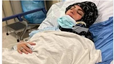 تطورات الحالة الصحية لـ ميار الببلاوى بعد تعرضها لإصابة خطيرة