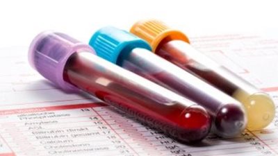 «طمن نفسك».. تعرف على تحليل التوافق لنقل الدم