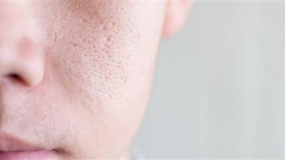 خطوات يومية لتضييق المسام الواسعة بالوجه.. اهتمي بجمالك