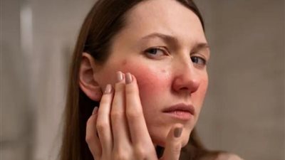 نصائح للحفاظ على البشرة والجلد مع ارتفاع درجات الحرارة