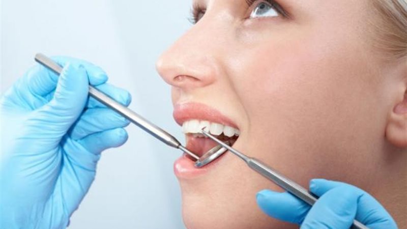 حالات علاج الأسنان
