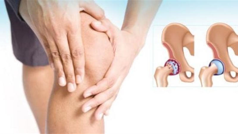 آلام العظام والتهاب