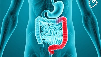 نصائح هامة لمرضى القولون خلال أيام عيد الأضحى المبارك