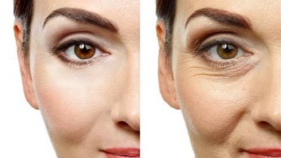 حيل سحرية لعلاج الخطوط تحت العين.. تعرفي عليها