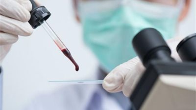 تفاصيل المرحلة الثانية للكشف عن البلهارسيا والطفيليات المعوية بـ15 محافظة