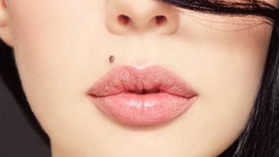 أبرزها مرض سرطان الجلد .. مخاطر هامة من وجود الشامات