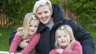 «بيعملوا كل حاجة عكس بعض».. شقيقتان توأم بميزة غريبة يصعب تصديقها فما قصتهما؟