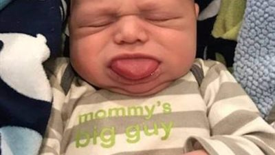 تريند السوشيال ميديا.. حكاية الطفل المولود بلسان 4 أضعاف حجم فمه