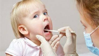 ما هي الأعراض المبكرة لالتهاب اللوز عند الأطفال؟