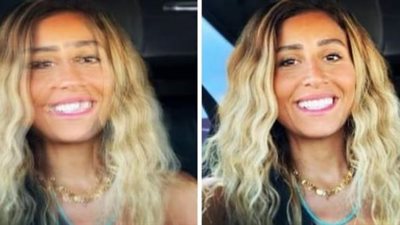 دينا الشربيني توجه نصائح عن ”ازدواجية الرؤية” في حملة ”شوف بعيني”.. تعرف عليها