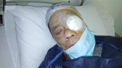 بعد إجرائه عملية جراحية خطيرة.. آخر تطورات الحالة الصحية لـ حلمي بكر