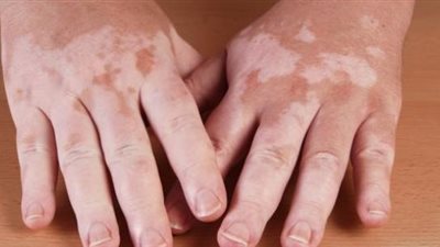 الأزهر يوضحها .. وصية هامة للنبي للتعامل مع المرضى بالطريقة الصحيحة