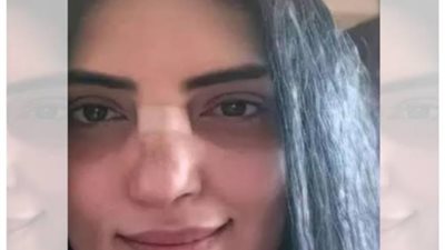 بالفيديو و الصور.. نكشف سر إخفاء وجه حورية فرغلى بعد نجاح العملية الثانية