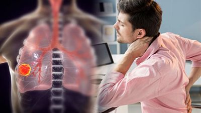 تعرفي على أسهل طريقة لعلاج سرطان الرئة