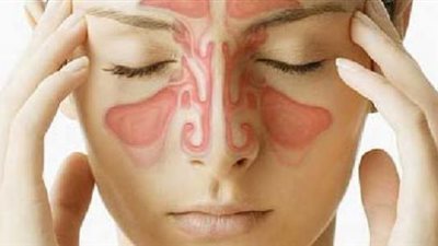 3 طرق للتغلب على التهاب الجيوب الأنفية في الربيع