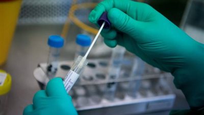 دراسة حديثة تكشف حقيقة العلاقة بين كورونا وفصيلة الدم