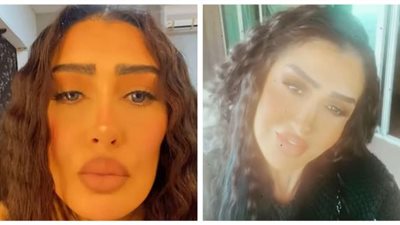 7 عمليات تجميل فاشلة.. تشوه وجه غادة عبد الرازق مدى الحياة (صور)