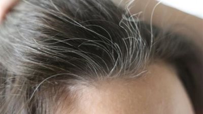 حيل سحرية لمنع الشيب المبكر للشعر .. تعرفي عليها