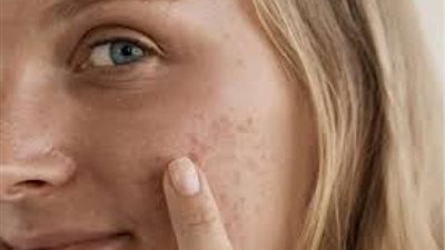 تعرف على العادات السيئة الضارة لصحة البشرة