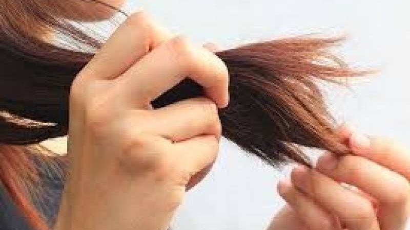 مشكلة تساقط الشعر
