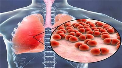 ازاي تتخلص من مشكلات الالتهاب الرئوي في منزلك؟