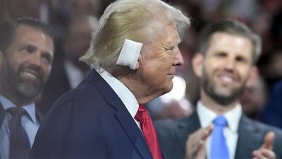 صور تُظهر أذن ترامب بعد إزالة الضمادة وكأن شيئًا لم يكن