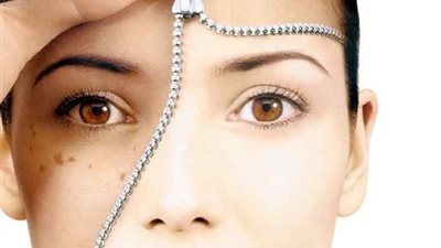 البقع الداكنة في الجسم.. روتين تقشير آمن في الصيف