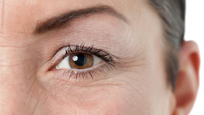لوجه خال من العيوب.. نصائح يومية للقضاء على تجاعيد العين