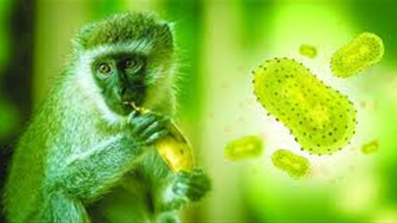 جدري القرود