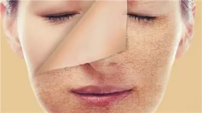 بسبب الحر.. مشروبات منعشة تقضي على جفاف الجسم في للصيف