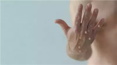 حقيقة انتشار جدري القرود في مصر.. وهذه أعراض المرض