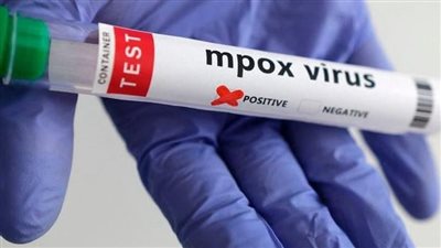 الهند تسجل أول حالة اشتباه بجدري القرود وسط حالة تأهب صحية