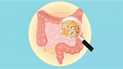  كل ما تحتاج لمعرفته عن بكتيريا الإيكولاي 