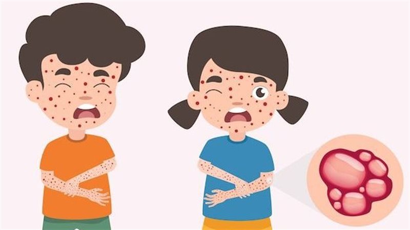 أمراض معديه تصيب
