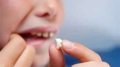  تفسير خلع الضرس في المنام للمتزوجة لابن سيرين.. تفاصيل 