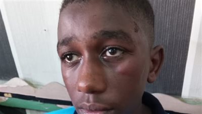 الاعتداء علي الطالب عثمان محمد عثمان في مدرسة بالإسكندرية يشعل التواصل الاجتماعي..  نكشف تفاصيل الواقعة  