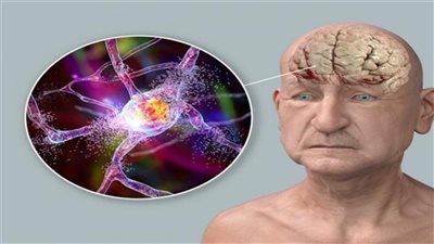 أغذية تبطئ شيخوخة الدماغ وتحافظ على صحته..  منها الشوكلاته الداكنة