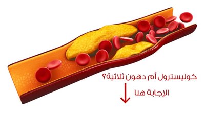 ما أفضل علاج لـ الكوليسترول والدهون الثلاثية؟.. طرق بسيطة وفعاله للعلاج