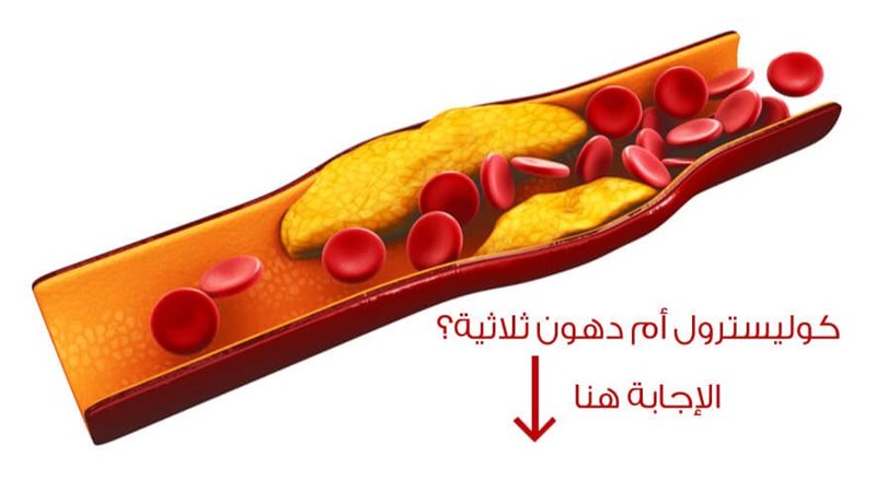علاج الكوليسترول